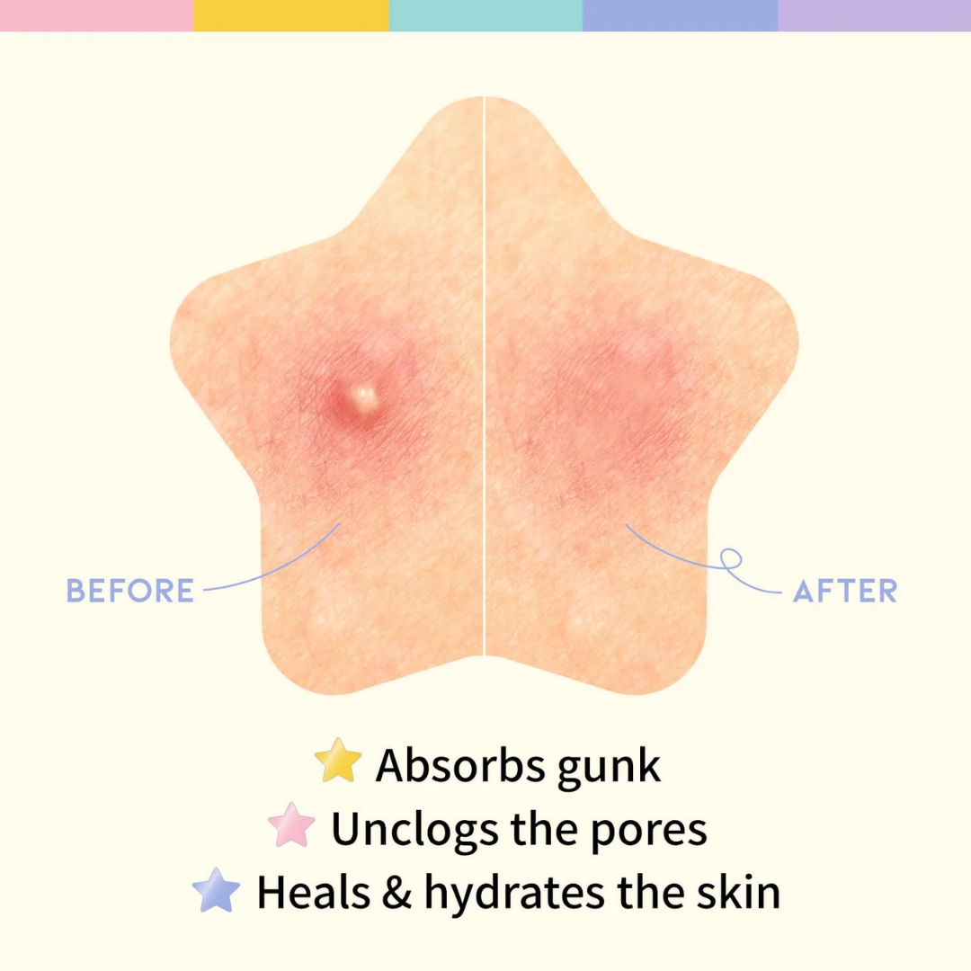 Star Spot Patch