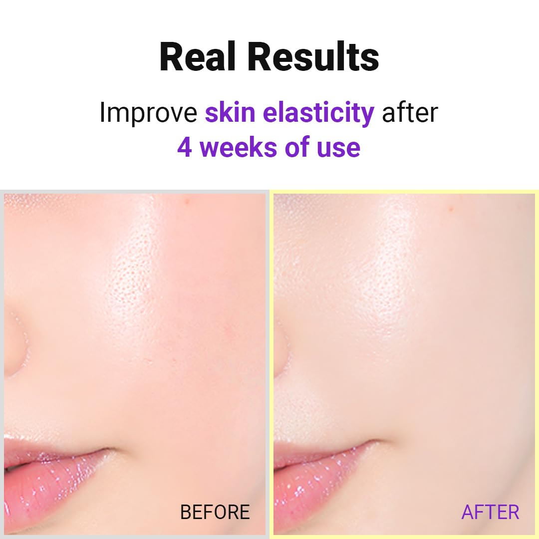 Hyper Retinol EX 1.0 Serum