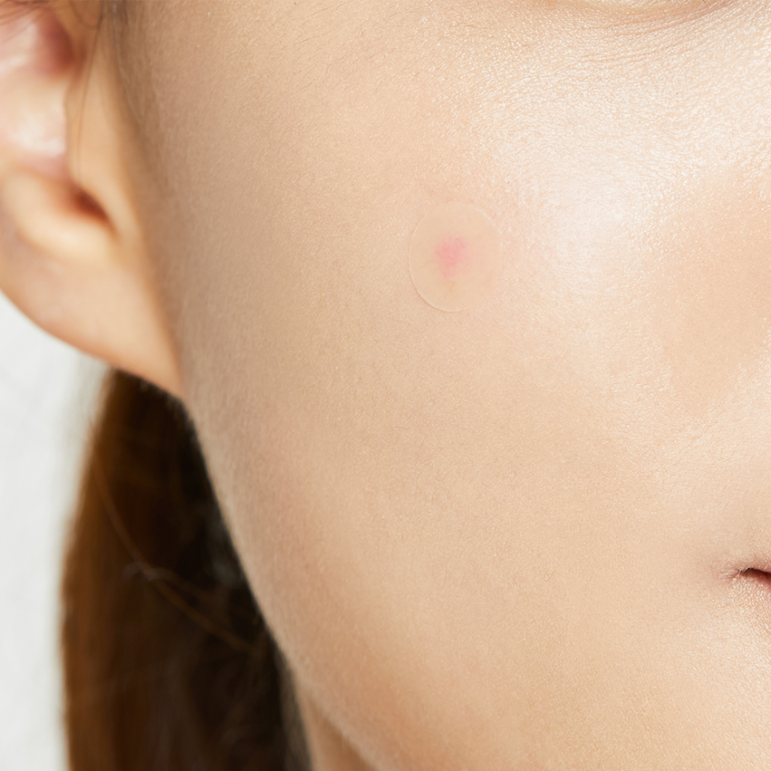Acné Pimple Master Patch