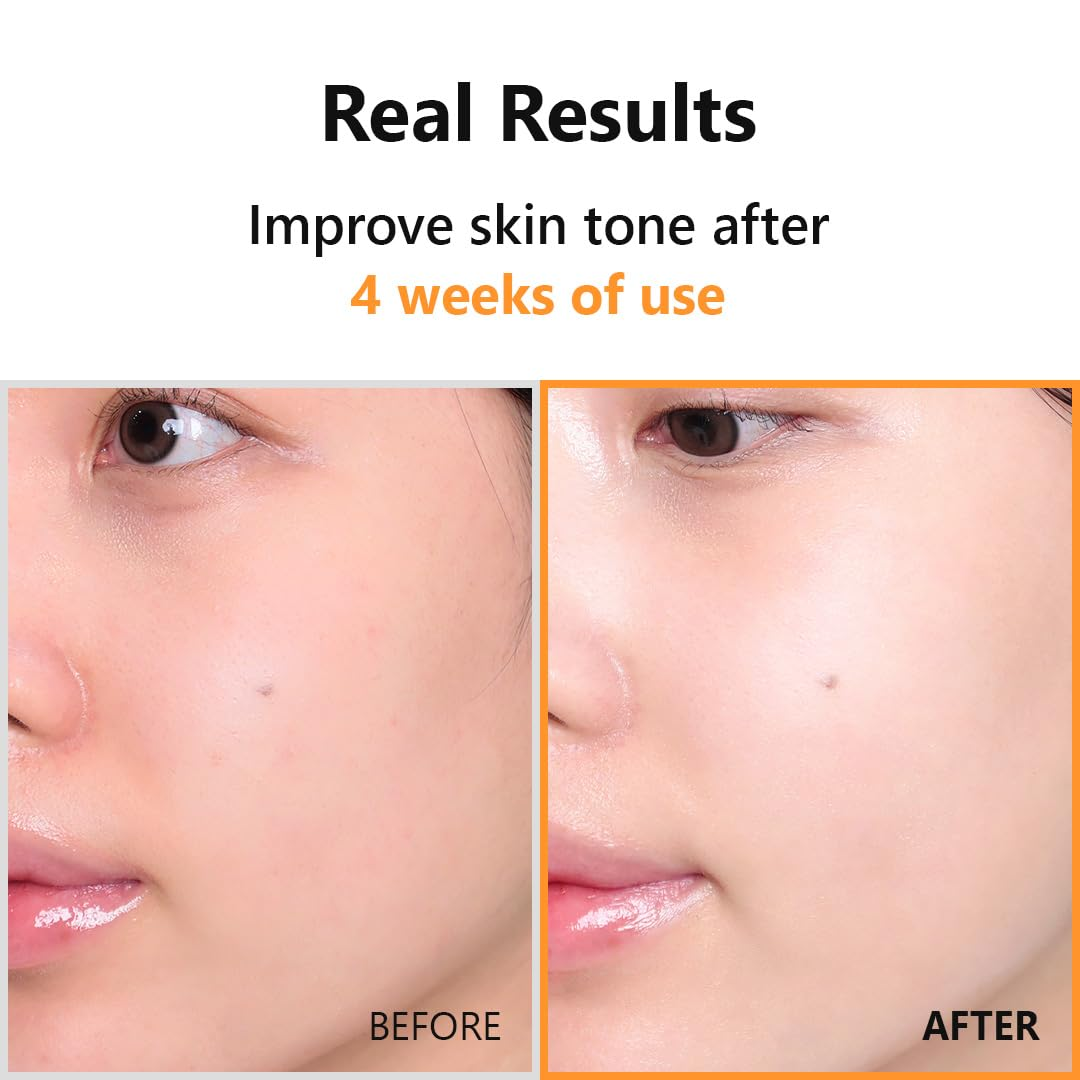 Hyper Vitamin C 23 Serum