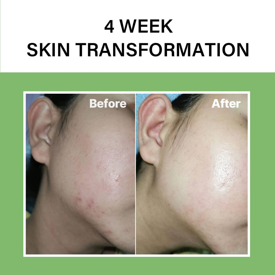 The Real Noni Energy Ampoule