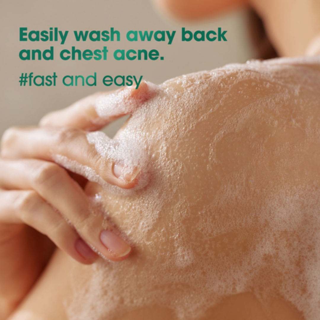 AHA, BHA, PHA 30 Days Miracle Acne Clear Body Cleanser