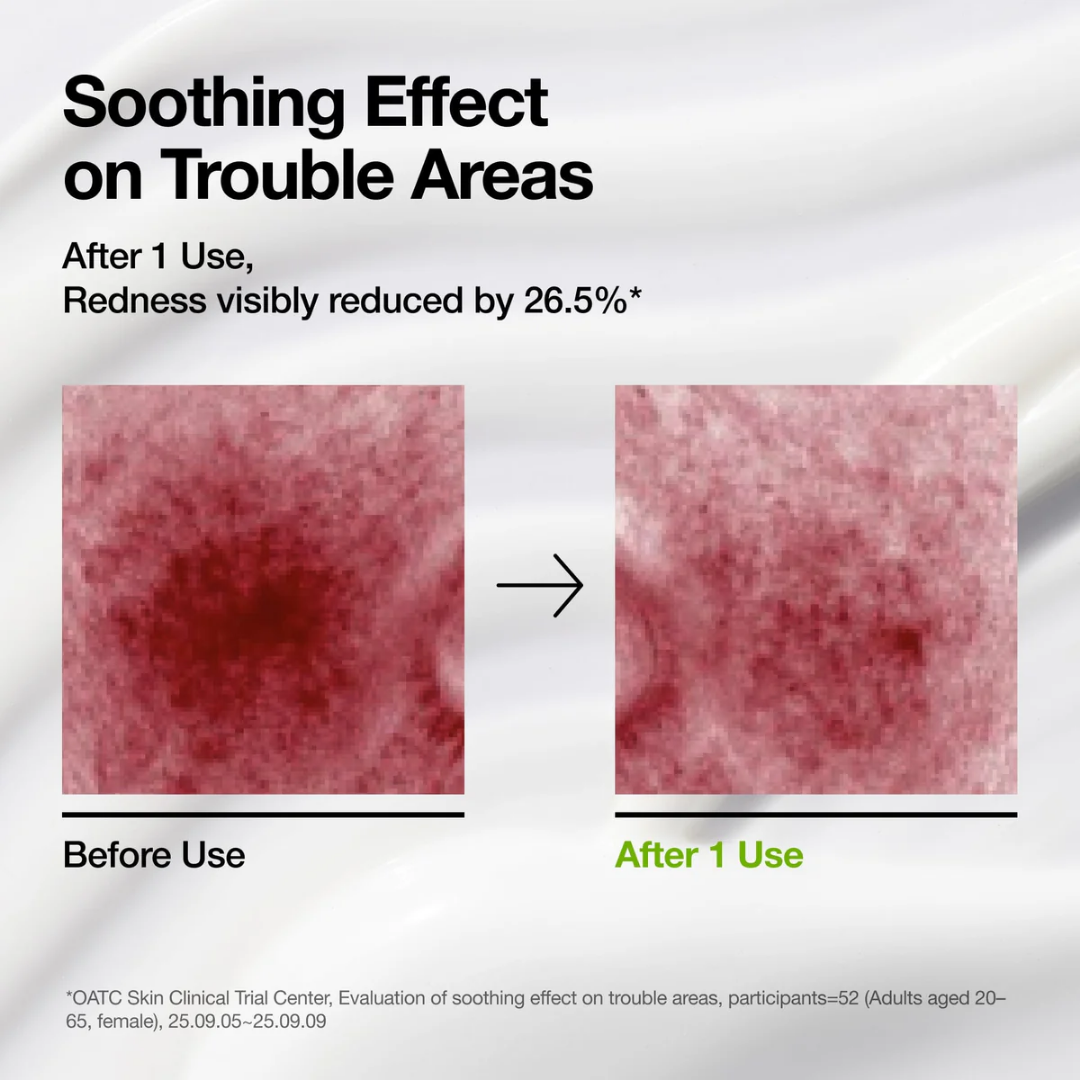 Azelaic Acid Cica Skin Soothing Moisturizer