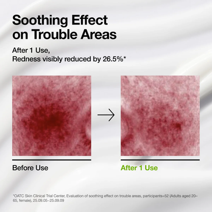 Azelaic Acid Cica Skin Soothing Moisturizer