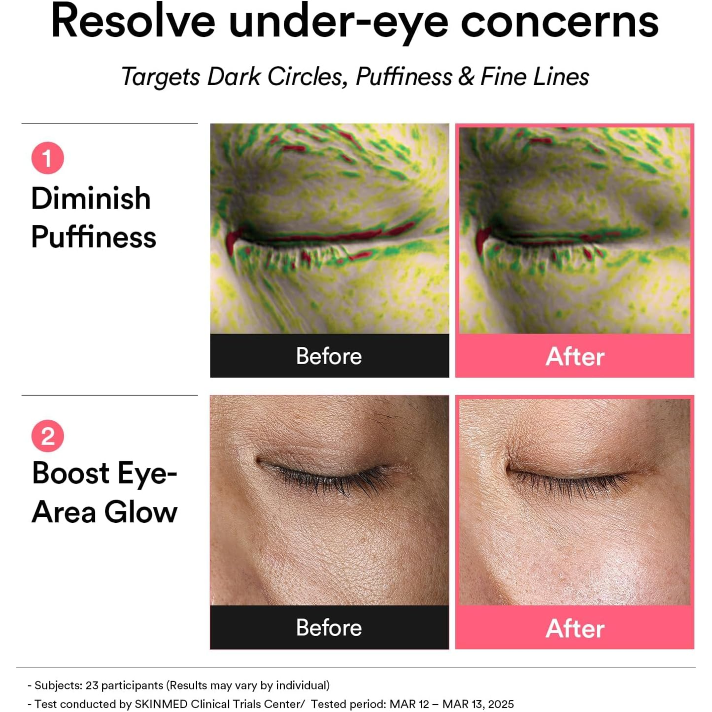 PDRN Retinal Eye Patch Glow Jelly [60 parches]