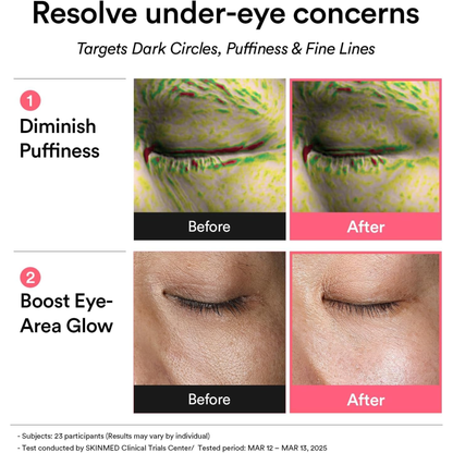 PDRN Retinal Eye Patch Glow Jelly [60 parches]